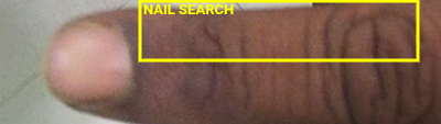 Nail Search ROI