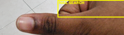 Nail Search ROI