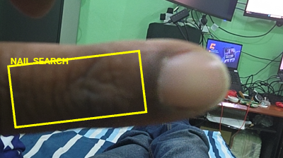 Nail Search ROI