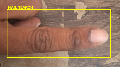 Nail Search ROI