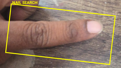 Nail Search ROI