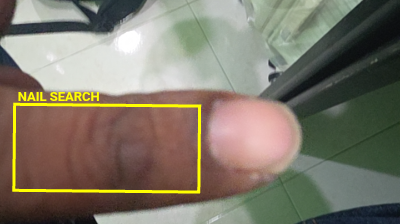 Nail Search ROI