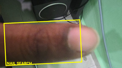 Nail Search ROI
