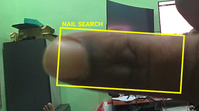 Nail Search ROI